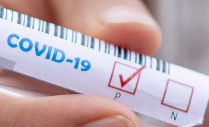 Regione: via al piano per i test sierologici per le forze dell'ordine ed i lavoratori del comparto giustizia